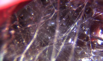 THINGS TO KNOW ABOUT FASCIA THINGS TO KNOW ABOUT FASCIA